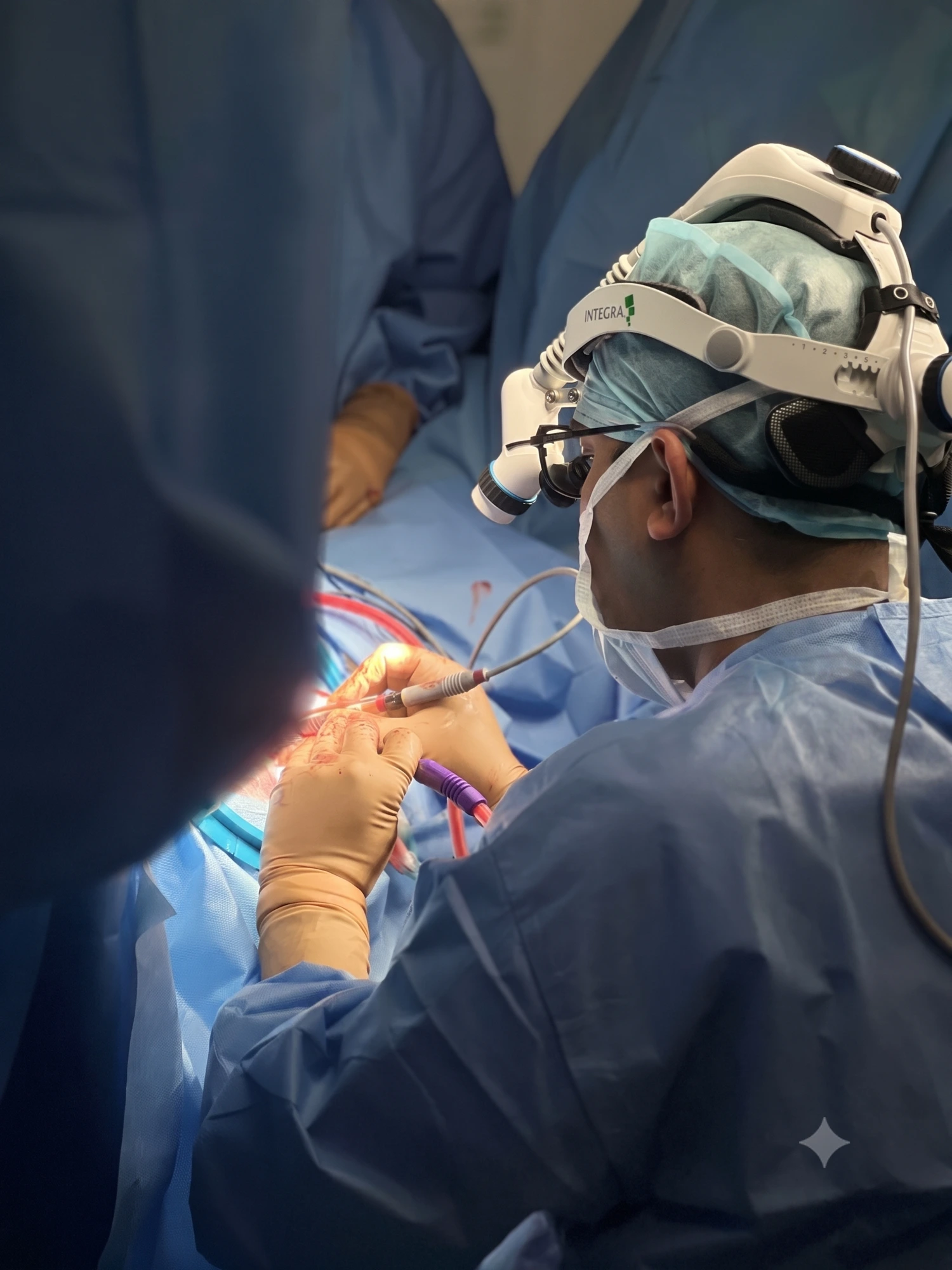 Dr. Santosh K performing surgery with a surgical headlight and loupes